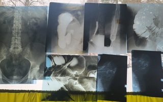 Röntgenkuva setti 6