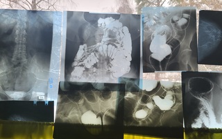 Röntgenkuva setti 5