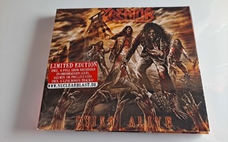 Kreator - Dying Alive (2xCD Limited Edition)