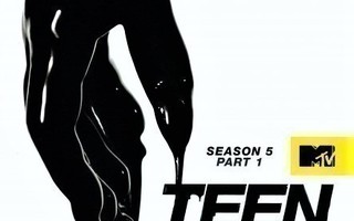 Teen Wolf Season 5, Part 1 (R0)(3Levyä)