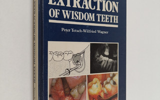 Peter Tetsch : Operative extraction of wisdom teeth