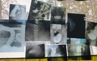 Röntgenkuva setti 4