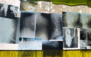 Röntgenkuva setti 1