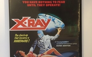 X-Ray (Blu-ray) Barbi Benton (1982) Slasher Classic Col. 9#