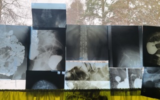 Röntgenkuva setti 3