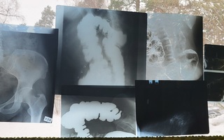 Röntgenkuva setti 2